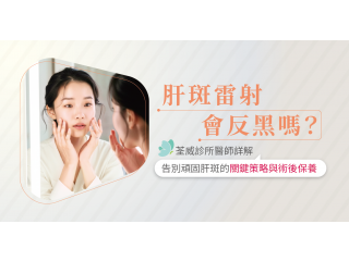 肝斑雷射會反黑嗎？荃威診所醫師詳解：告別頑固肝斑的關鍵策略與術後保養