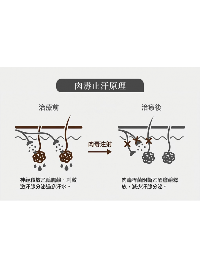 想打「保妥適肉毒」？荃威診所醫師詳解：告別皺紋、瘦小臉，一篇搞懂價格、效果與術後保養