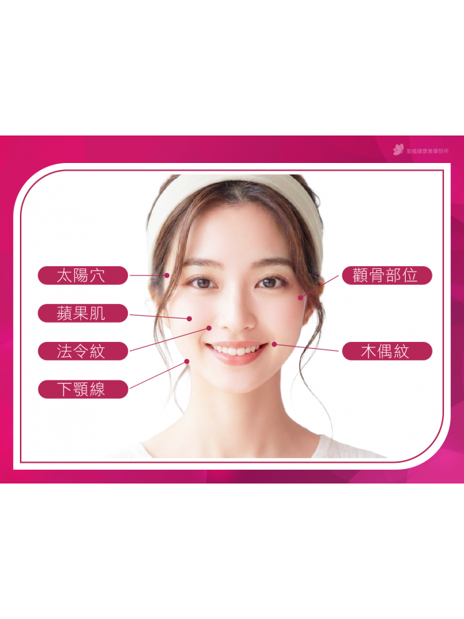 4D童顏適合改善哪些部位?誰適合施打? 4D童顏適合改善哪些部位?誰適合施打?