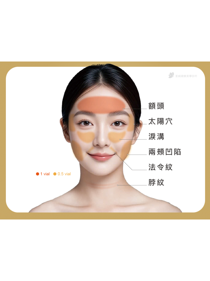 三、 哪些部位適合使用妮芙蕾?打造全臉立體美學 三、 哪些部位適合使用妮芙蕾?打造全臉立體美學