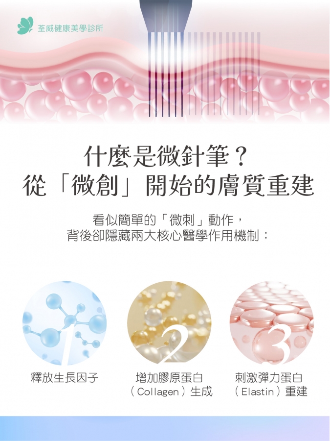 毛孔粗大、凹疤救星？揭開「微針筆 Microneedling」煥膚原理：比雷射更溫和的物理性修復選擇