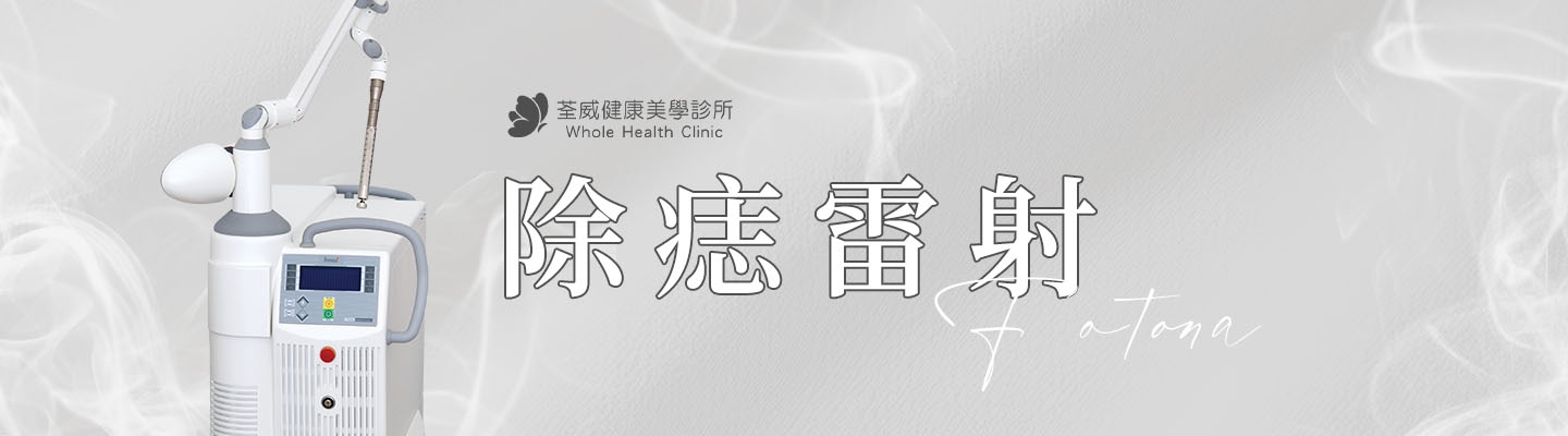 FOTONA 除痣