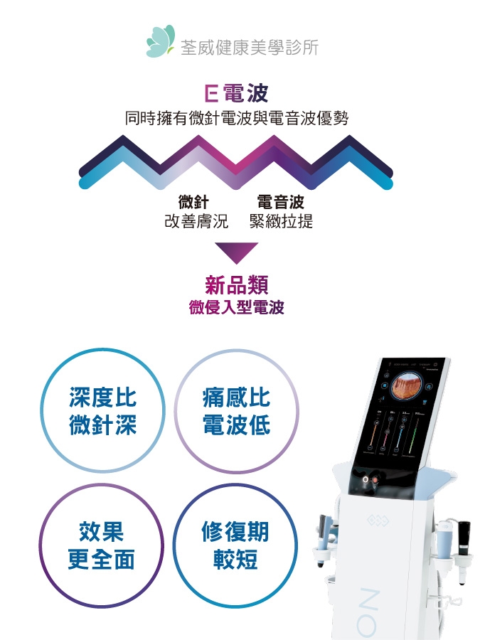 EXION 時空E電波｜荃威診所