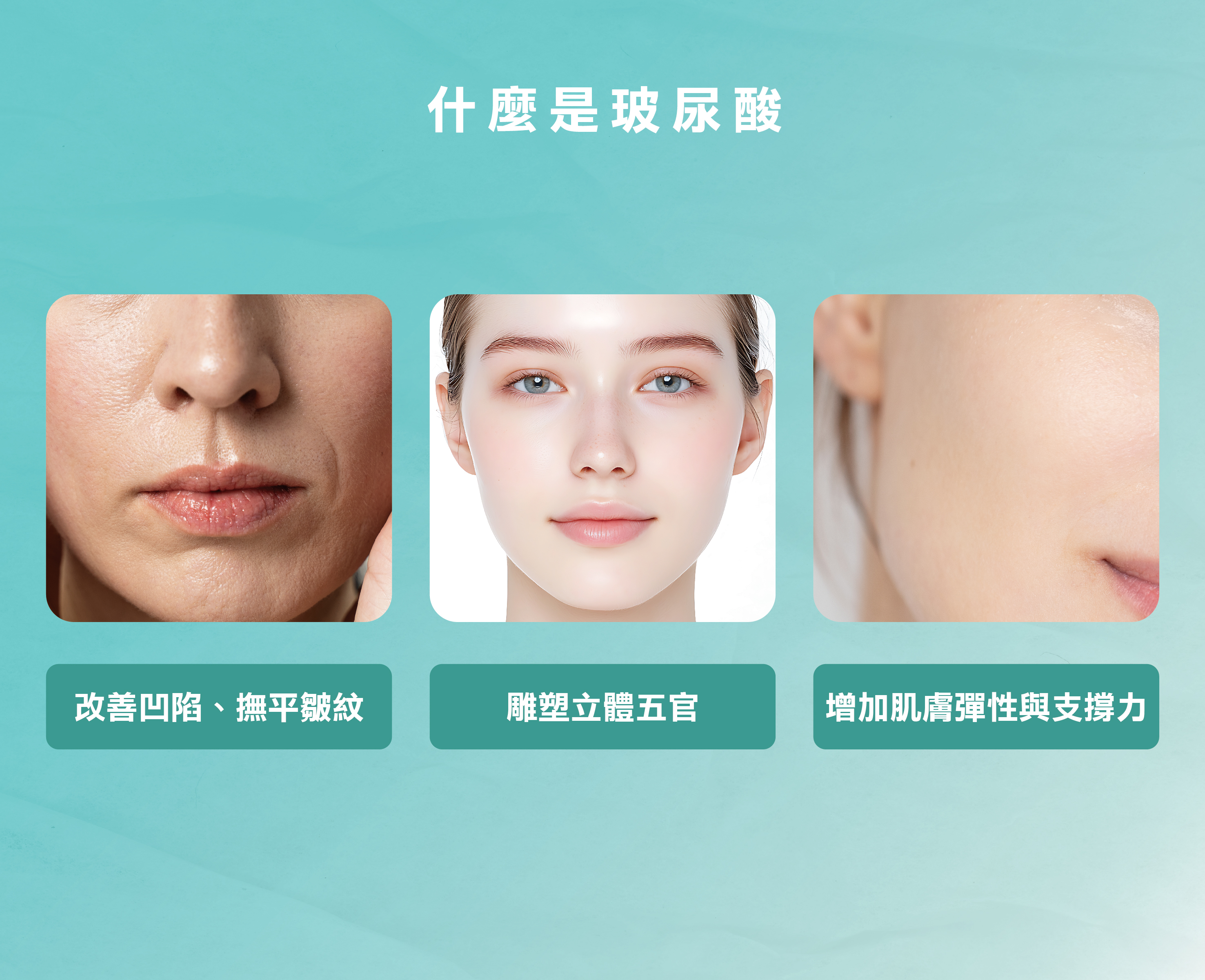 什麼是玻尿酸？為什麼醫美離不開它？