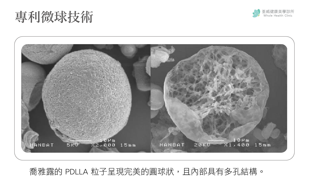 二、深度科學：PDLLA + HA 的黃金配方與微球技術