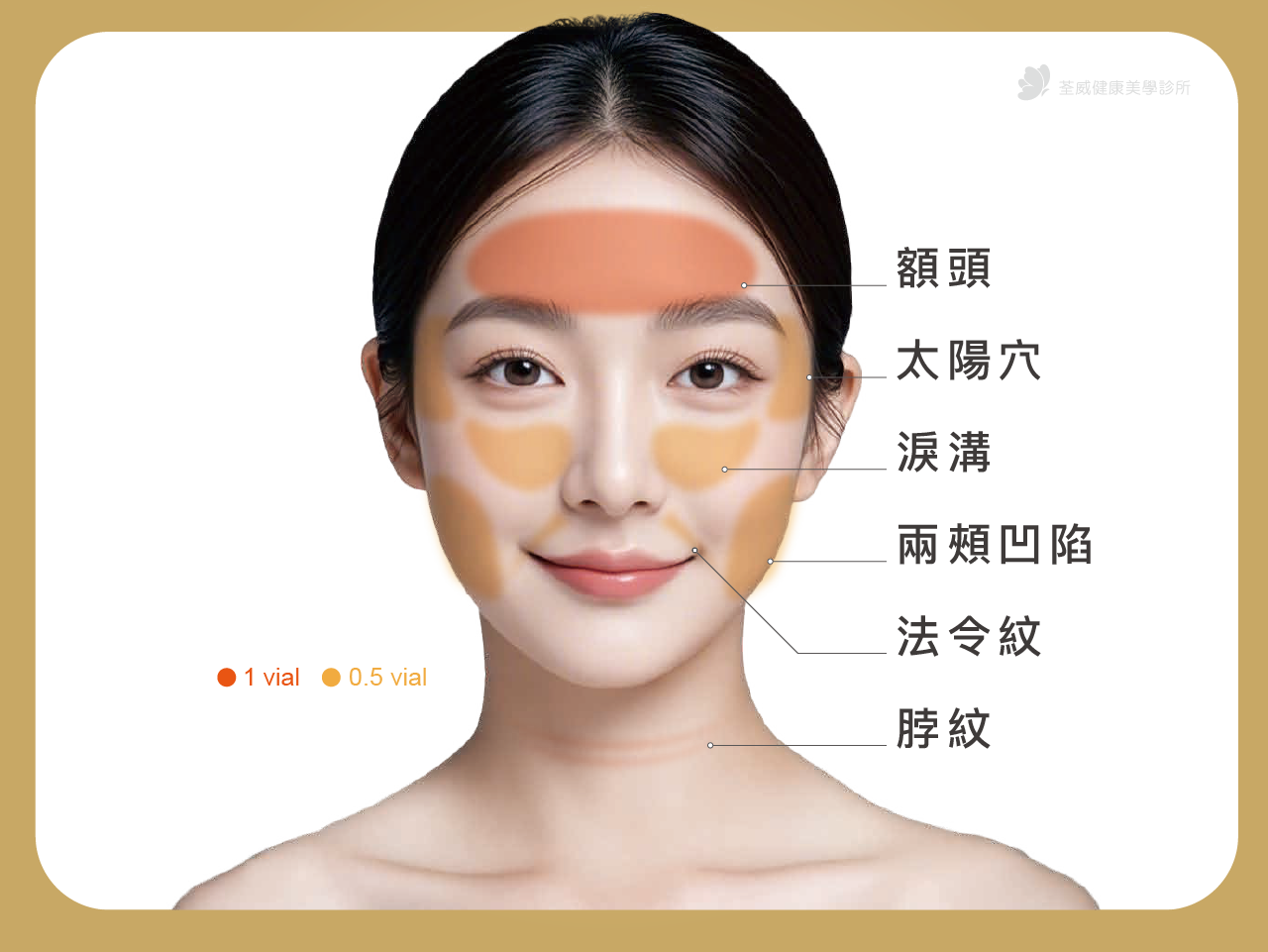 三、 哪些部位適合使用妮芙蕾?打造全臉立體美學 三、 哪些部位適合使用妮芙蕾?打造全臉立體美學