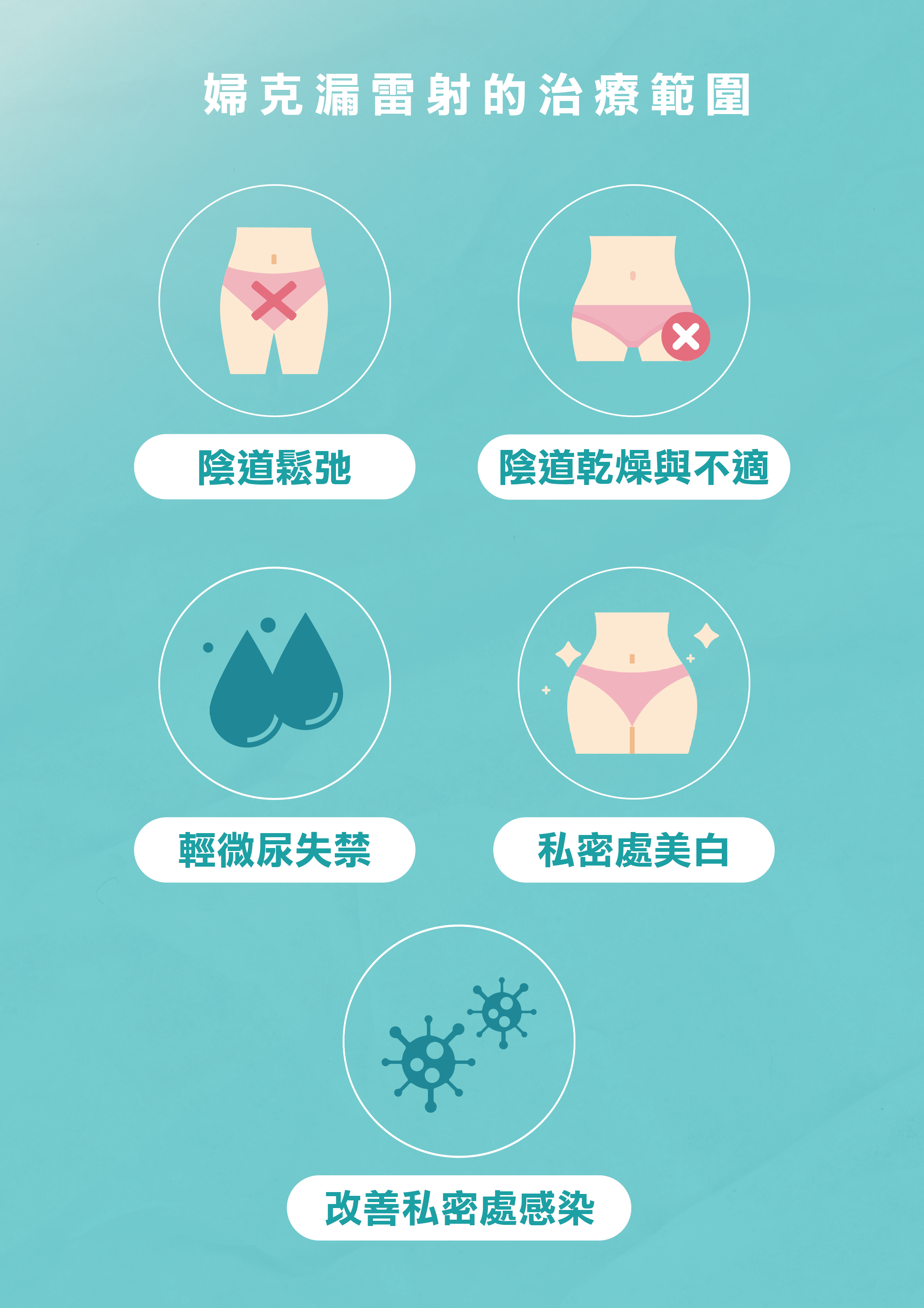 婦克漏雷射的治療範圍