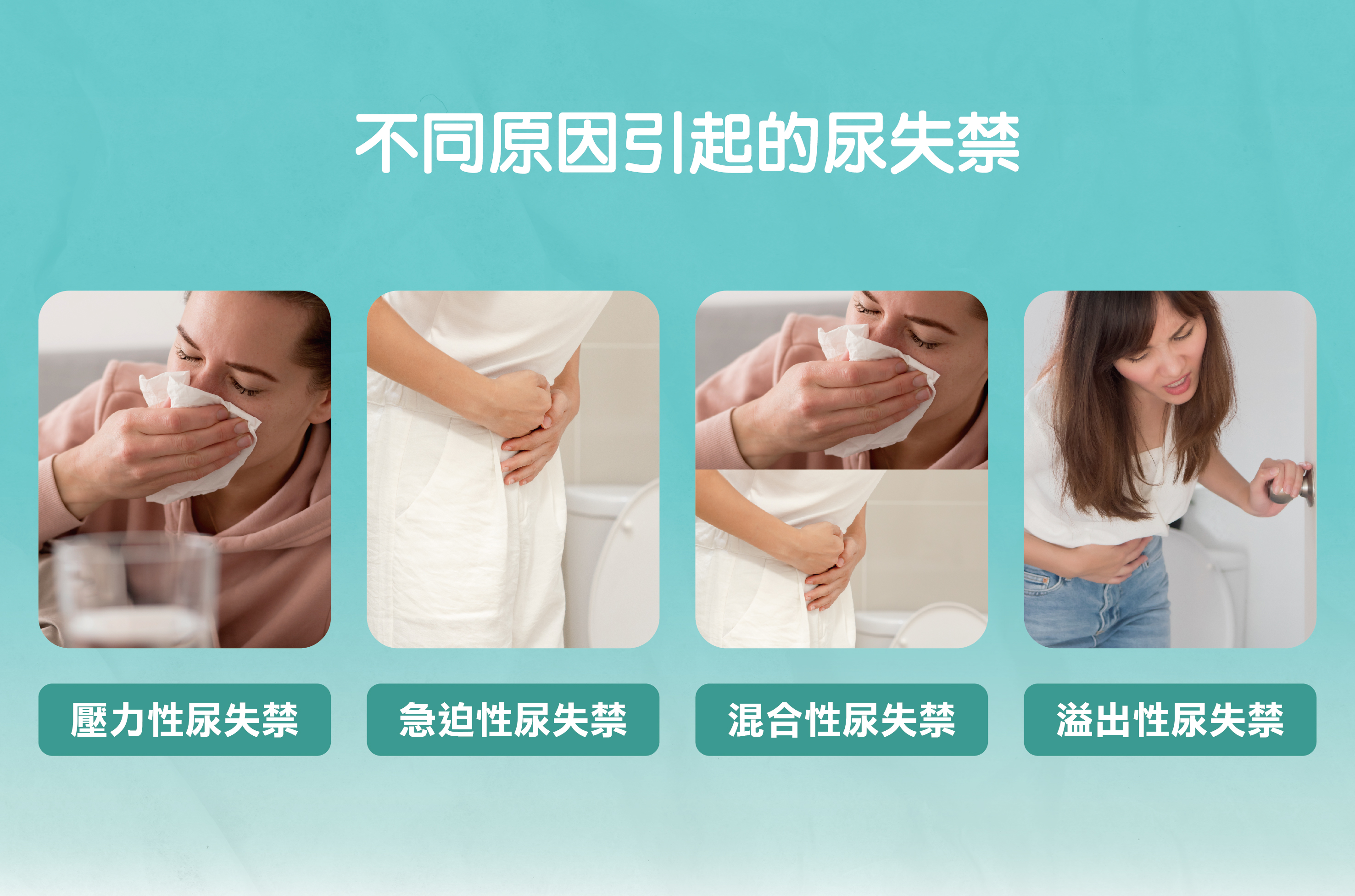 不同原因引起的尿失禁