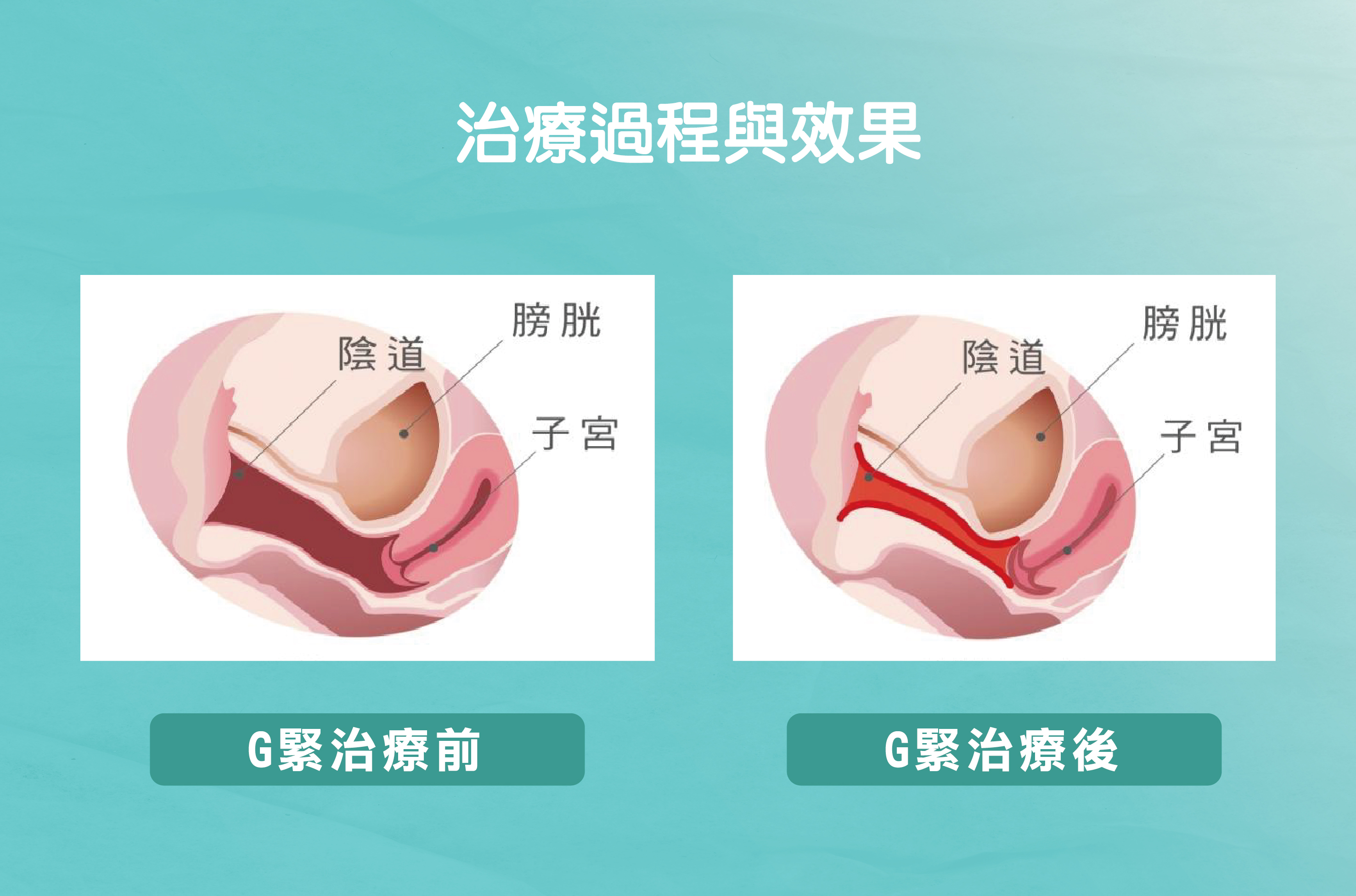 治療過程與效果