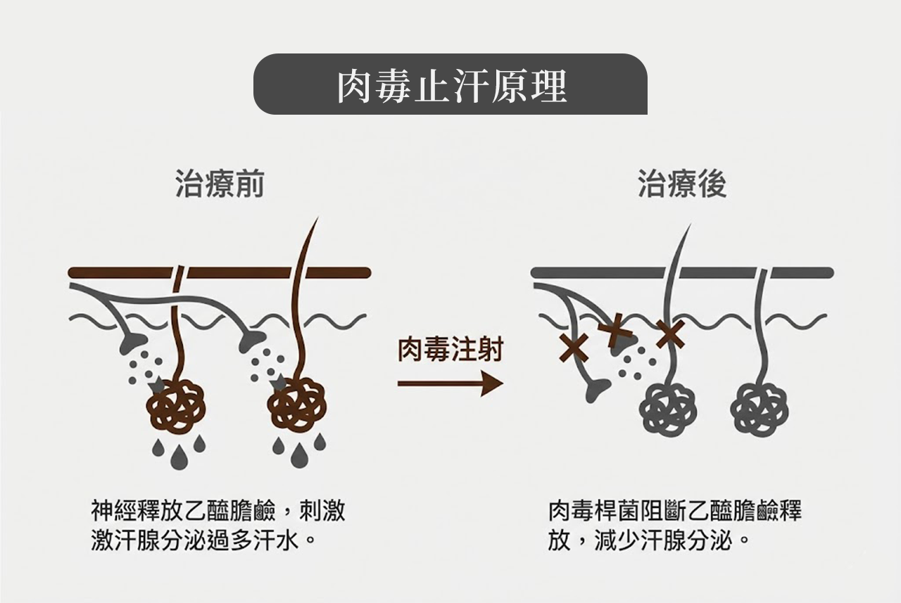抑制多汗與異味 (止汗)
