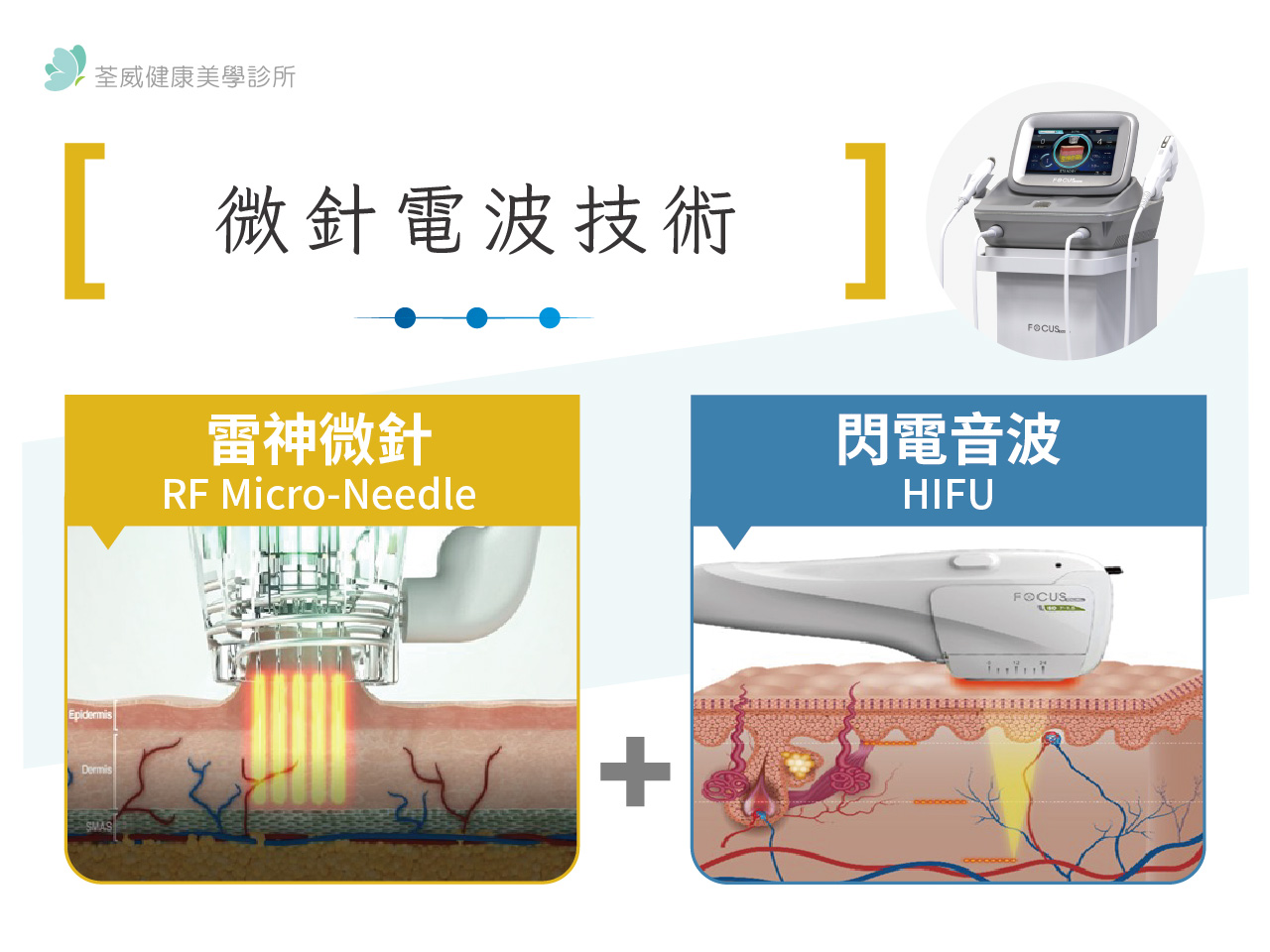 微針電波是什麼？修復期多久？效果、價格與台北微針電波推薦｜荃威診所-醫美診所台北第一首選