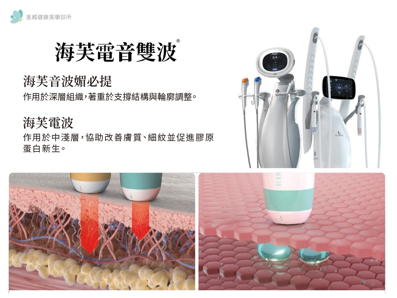 2026 醫美趨勢海芙電音雙波-台北南港荃威診所