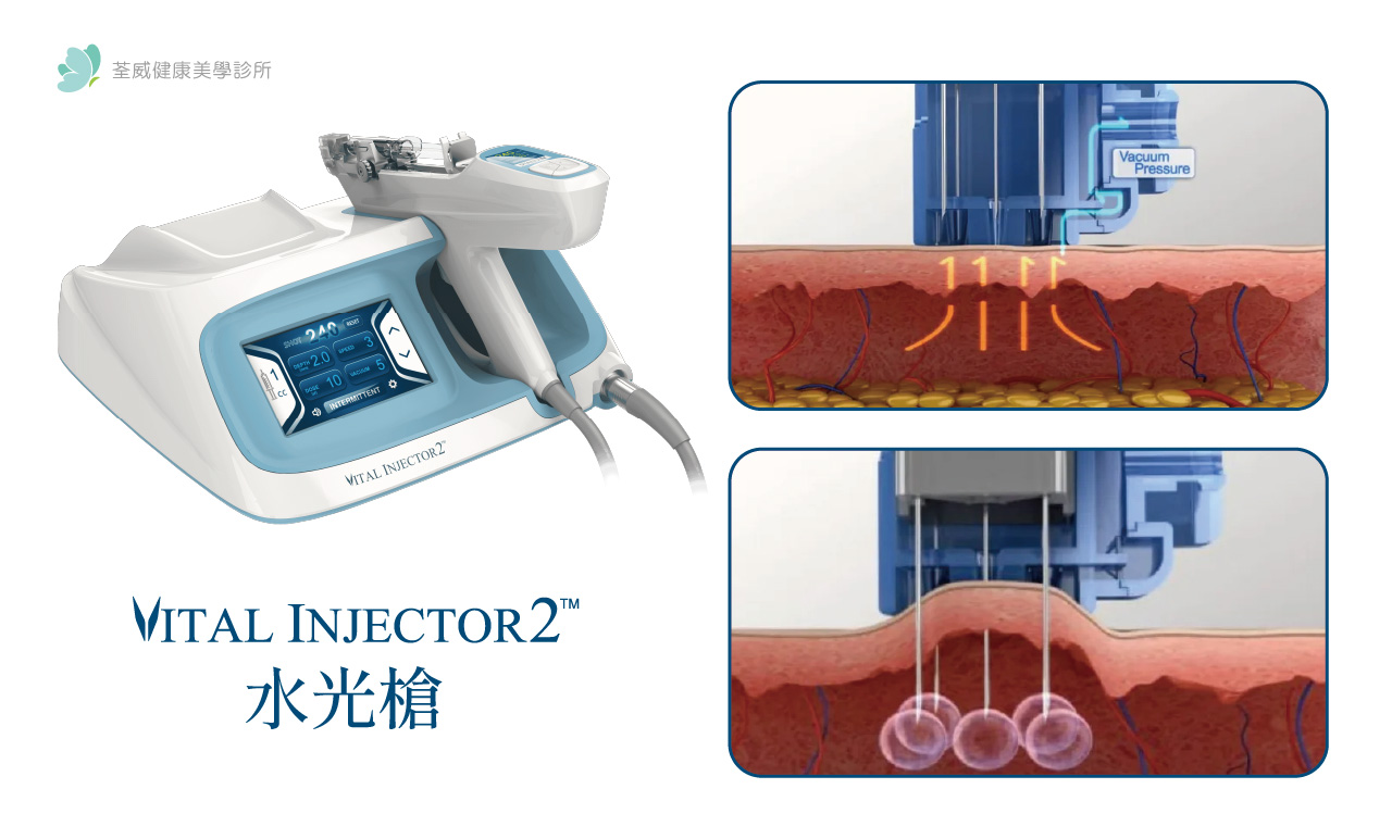 水光槍 Vital Injector 2 讓肌膚喝飽水，輕鬆擁有女神光 荃威診所
