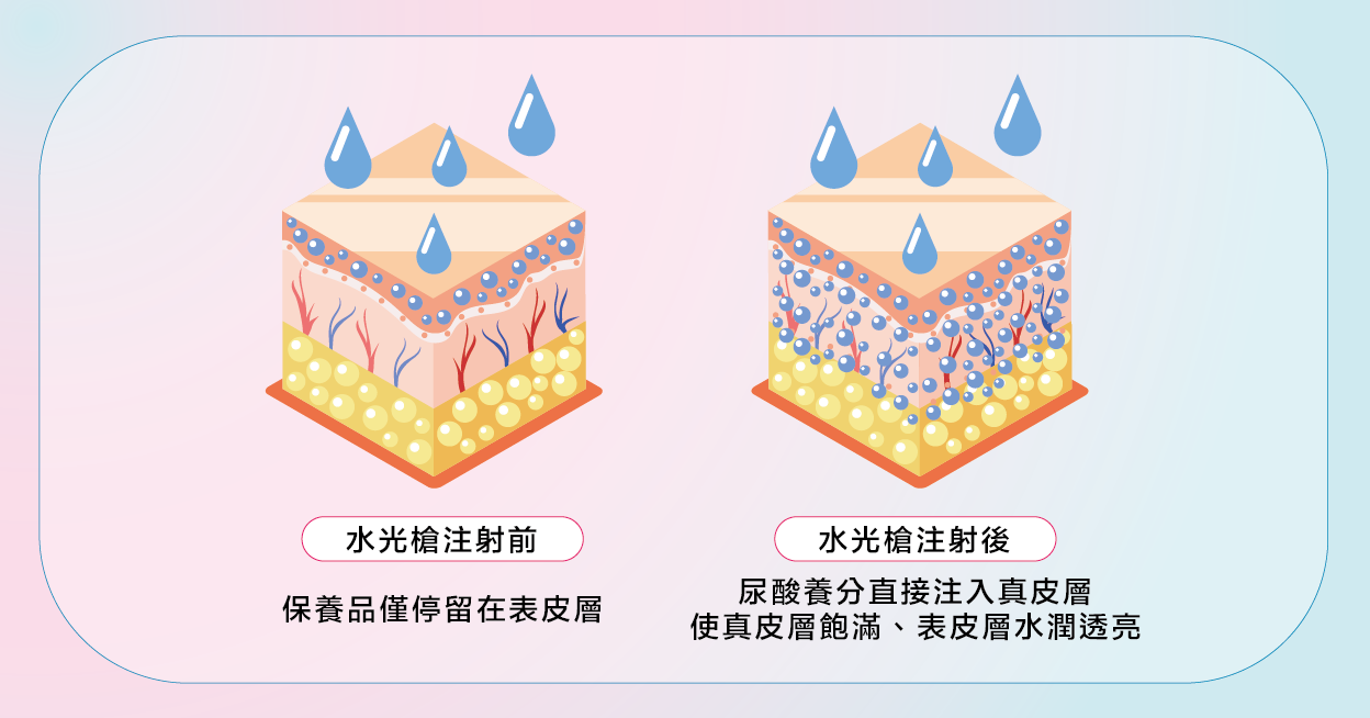 水光槍 vs. 傳統保養