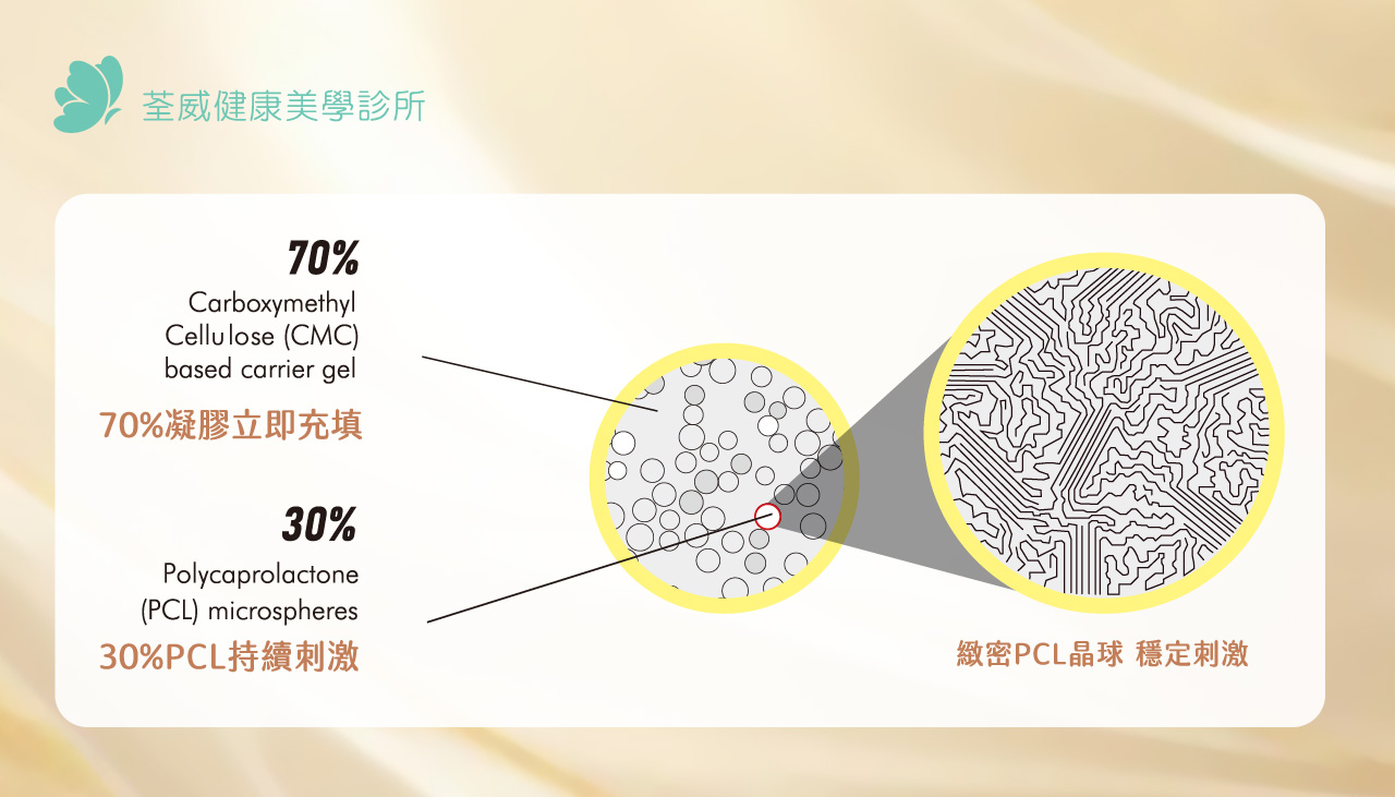 EllANSÉ 洢蓮絲(少女針)是什麼？效果、價格與維持時間與適用部位