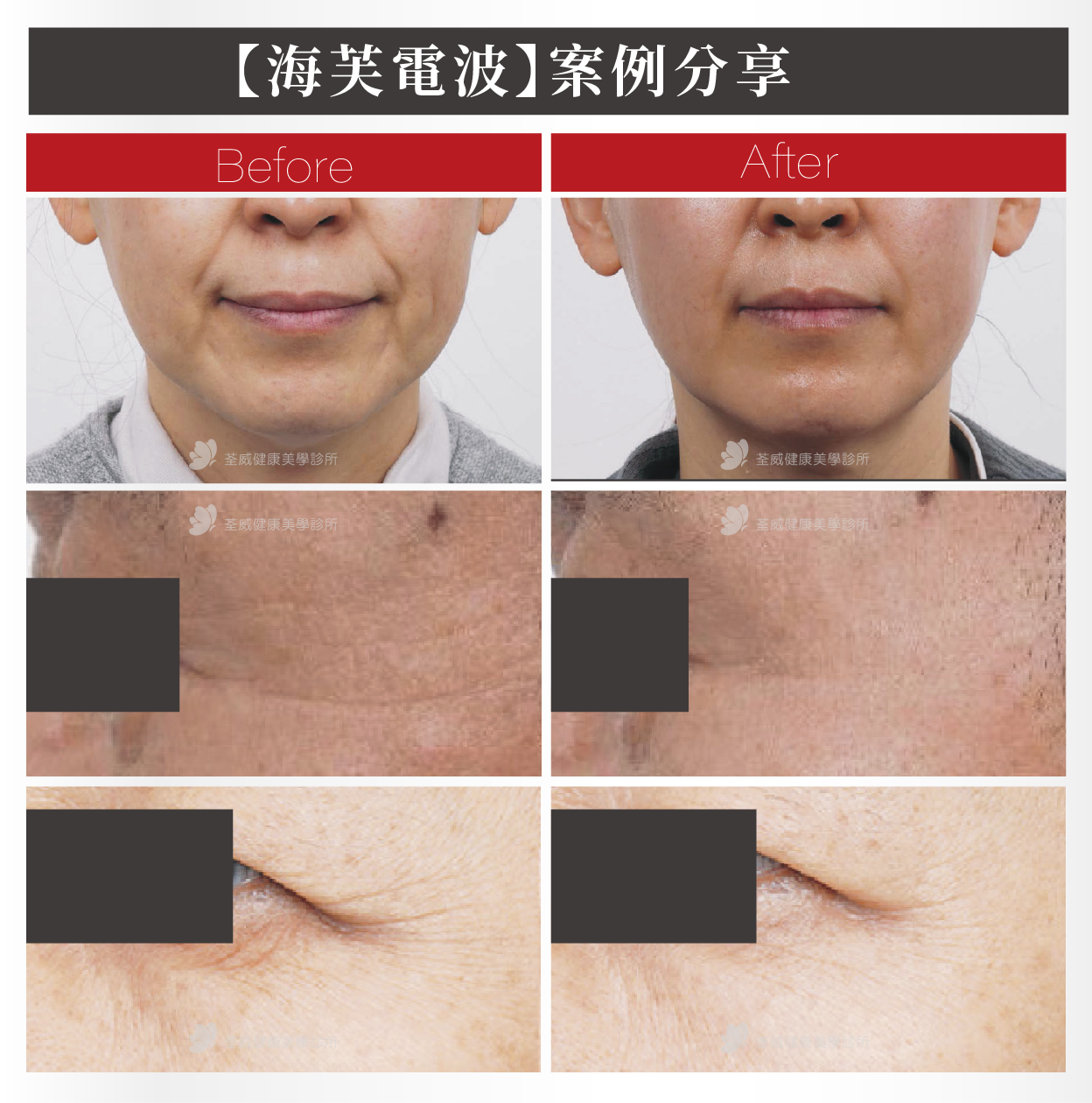 海芙電波案例分享