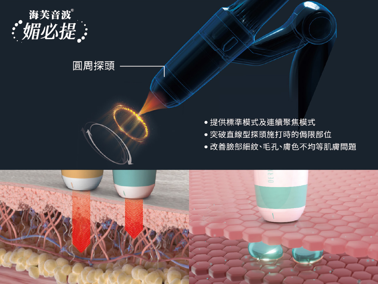 海芙音波到底厲害在哪?拉提效果、維持時間、費用與風險全整理! 海芙音波到底厲害在哪?拉提效果、維持時間、費用與風險全整理!