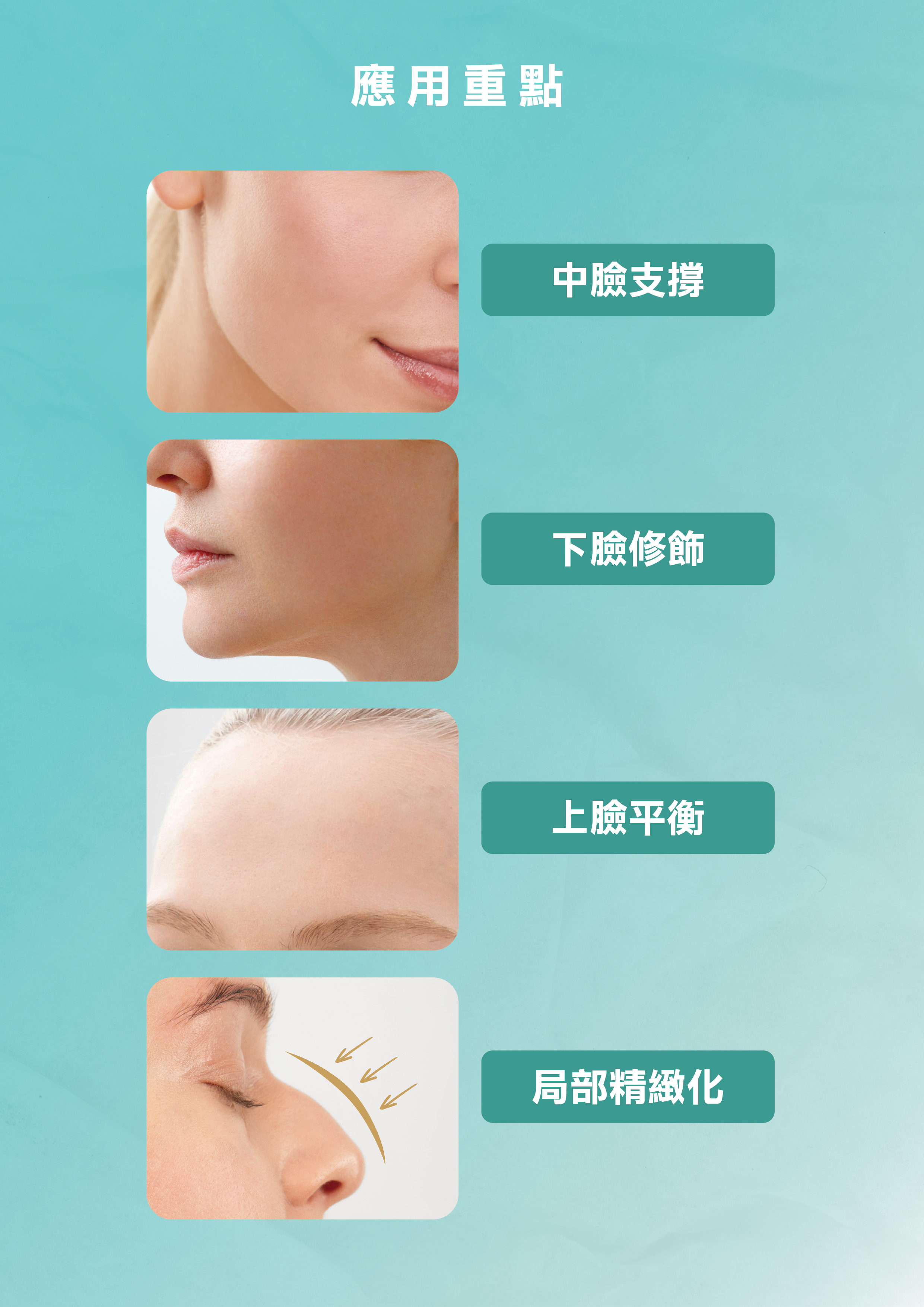 常見的應用重點包括：