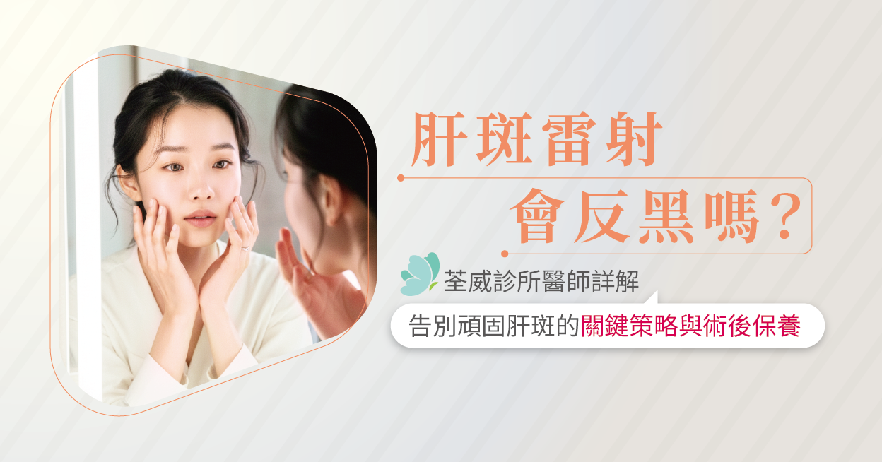 肝斑雷射會反黑嗎？荃威診所醫師詳解：告別頑固肝斑的關鍵策略與術後保養