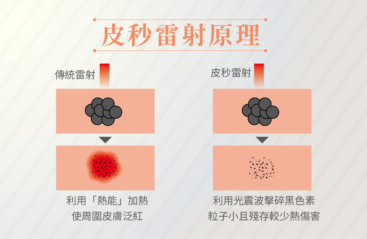 皮秒雷射作用原理