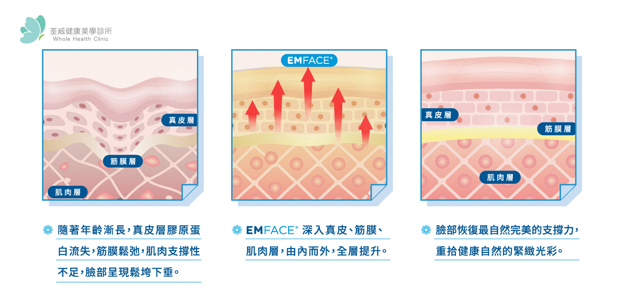 EMFACE 菲斯波|荃威診所・頂級抗老首選 EMFACE 菲斯波|荃威診所・頂級抗老首選