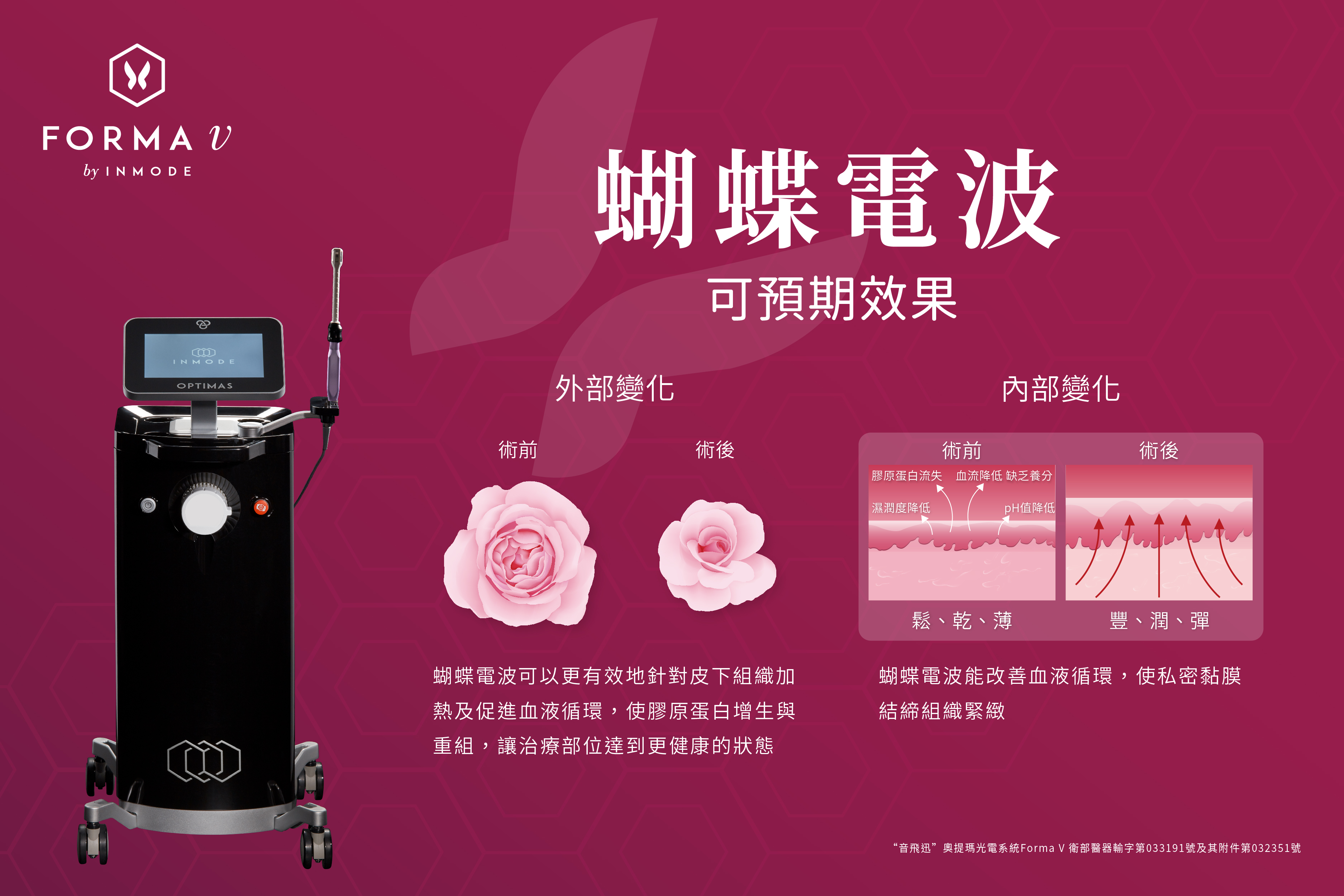 FORMA V 蝴蝶電波｜南港私密保養推薦：專業女醫師團隊 - 荃威健康美學診所