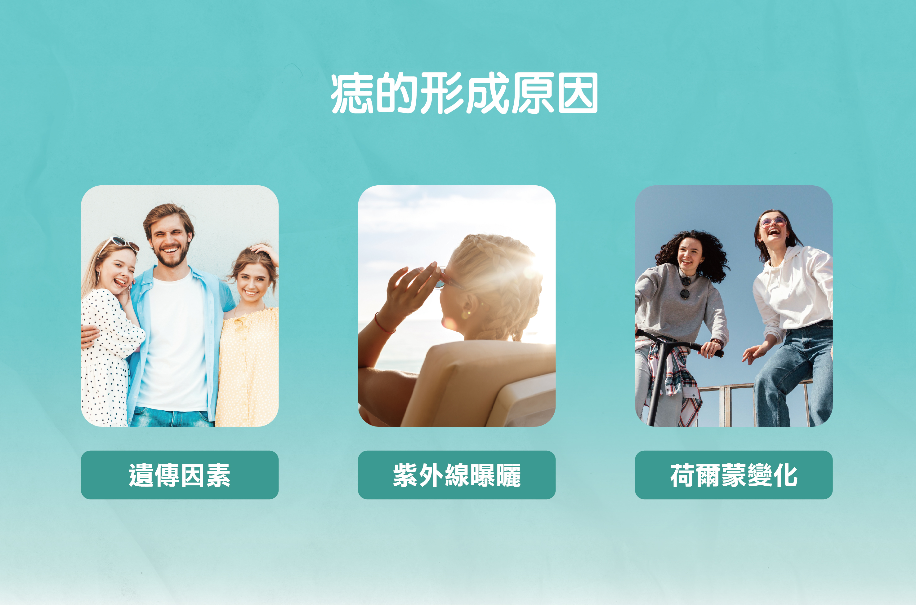 痣的形成主要與基因、紫外線曝曬及荷爾蒙等因素有關：