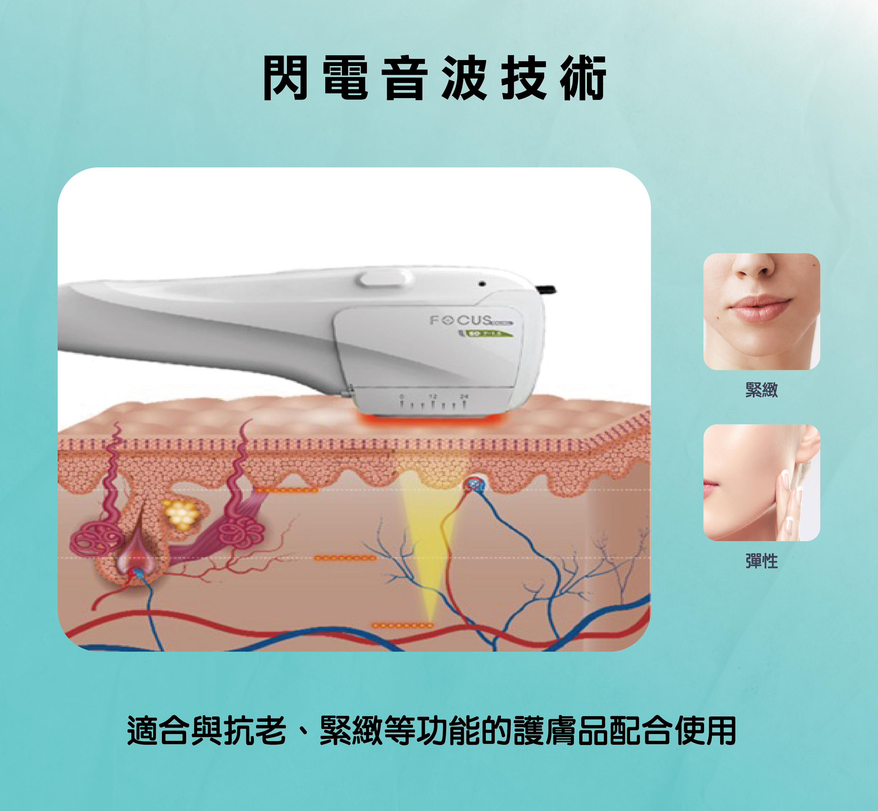 閃電音波技術（Ultrasound Therapy）