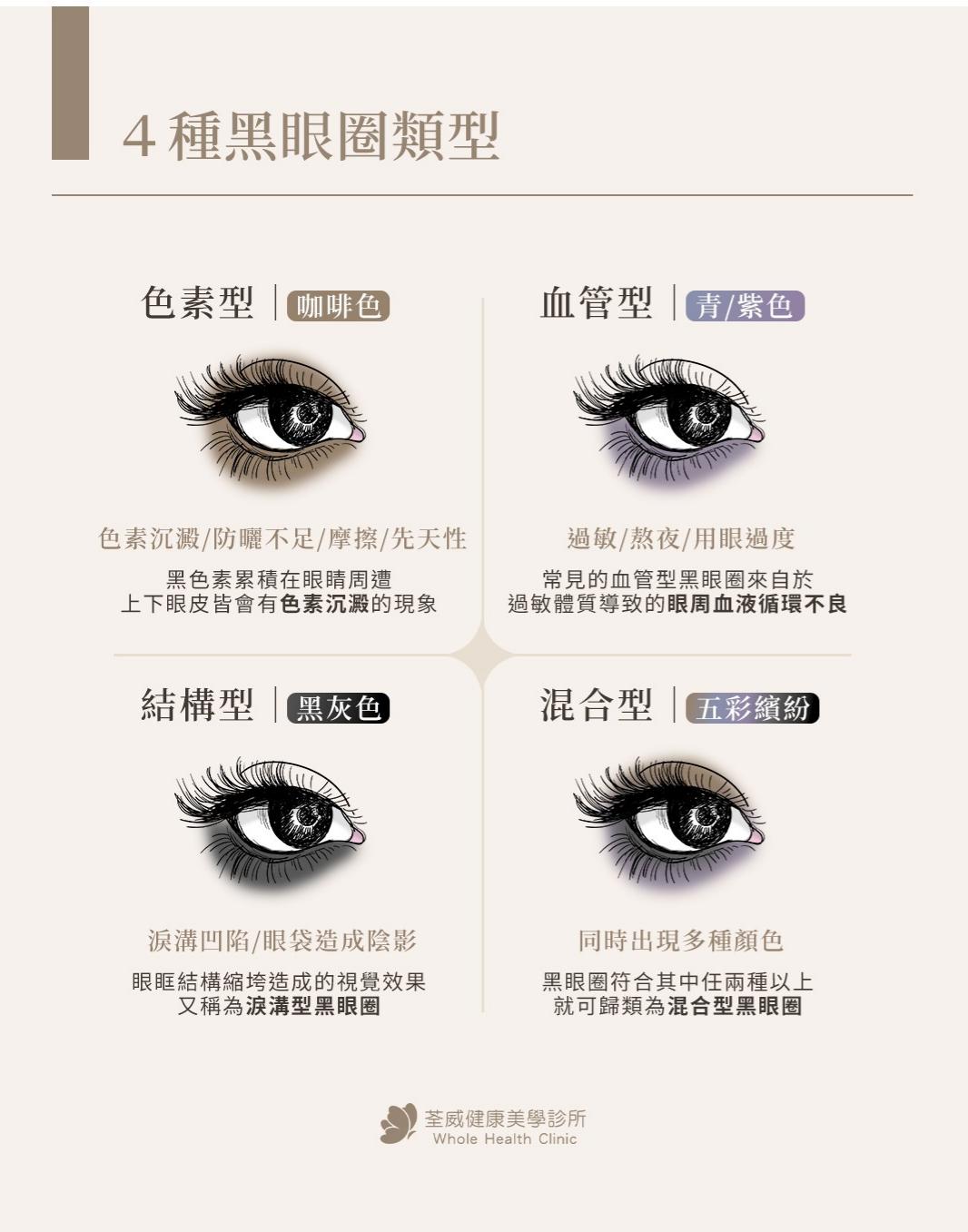 熊貓眼還有救嗎?黑眼圈雙機雷射:客製化擊退沉澱色素、重現亮采雙眸|荃威診所 熊貓眼還有救嗎?黑眼圈雙機雷射:客製化擊退沉澱色素、重現亮采雙眸|荃威診所