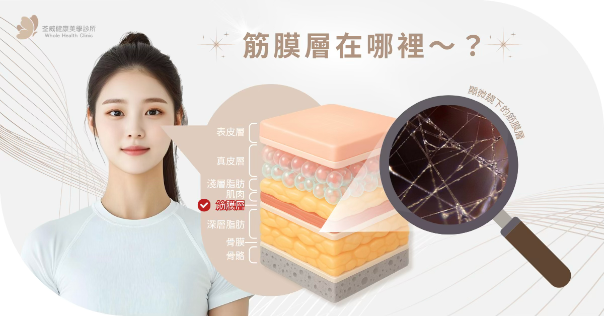 無痕筋膜拉提是什麼？它跟傳統拉皮有何不同？