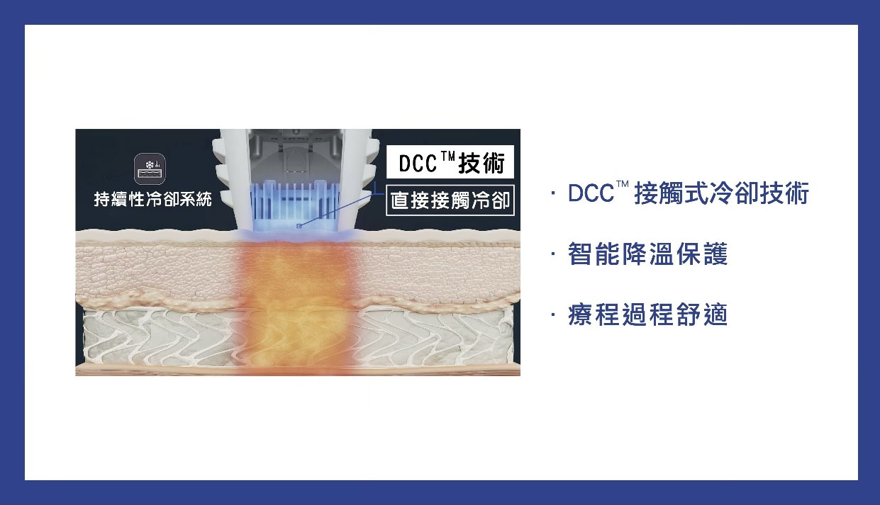 為何皇后電波能做到「舒適無痛」？