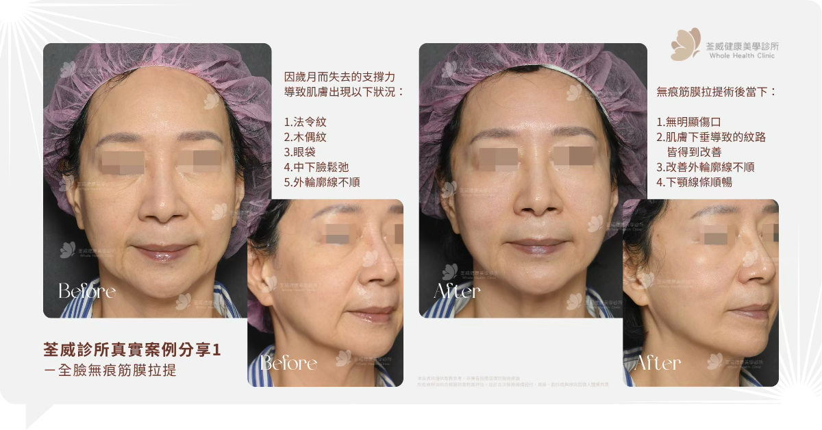 荃威診所真實案例分享 (E-E-A-T 核心)