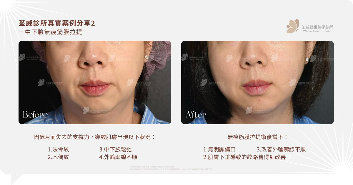 荃威診所真實案例分享 (E-E-A-T 核心)