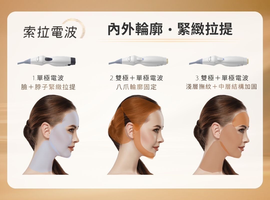 索住輪廓・拉回時光|Sunny RF 索拉電波:雙模態分層抗衰新紀元 索住輪廓・拉回時光|Sunny RF 索拉電波:雙模態分層抗衰新紀元