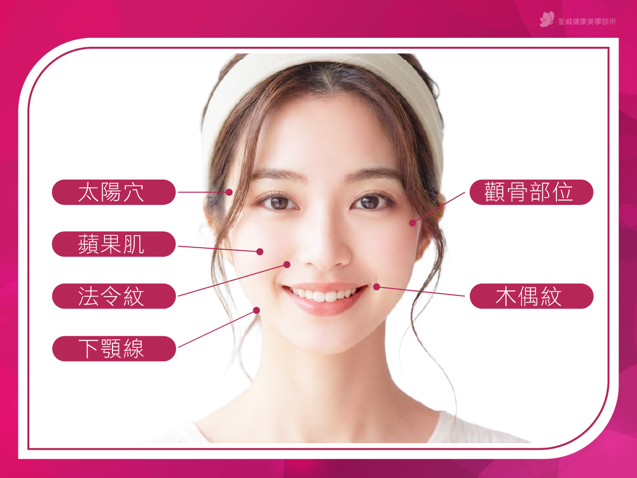 【4D童顏針全解析】悄悄變美的秘密！喚醒自體膠原蛋白，打造自然澎潤少女感｜荃威診所