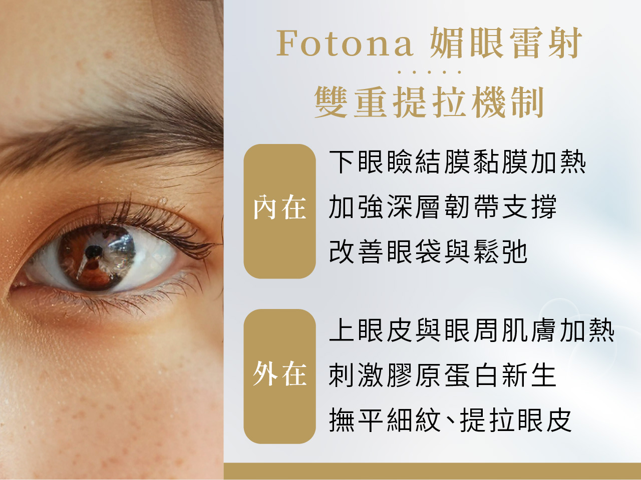 Fotona 媚眼雷射|告別眼皮下垂與眼周細紋,重塑明亮緊緻雙眸 Fotona 媚眼雷射|告別眼皮下垂與眼周細紋,重塑明亮緊緻雙眸