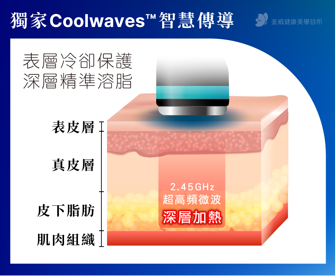 Coolwaves™ 智慧傳導：表層冷卻保護，深層精準溶脂。