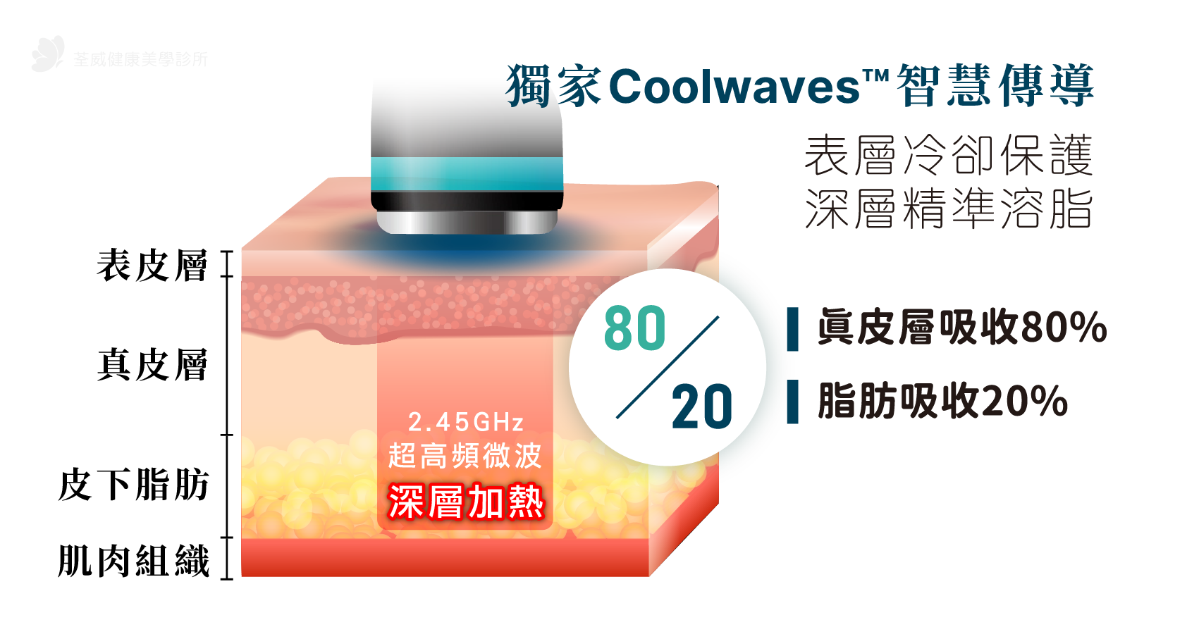 2｜Onda Pro 原理解析：2.45GHz 微波如何做到又快又不痛？