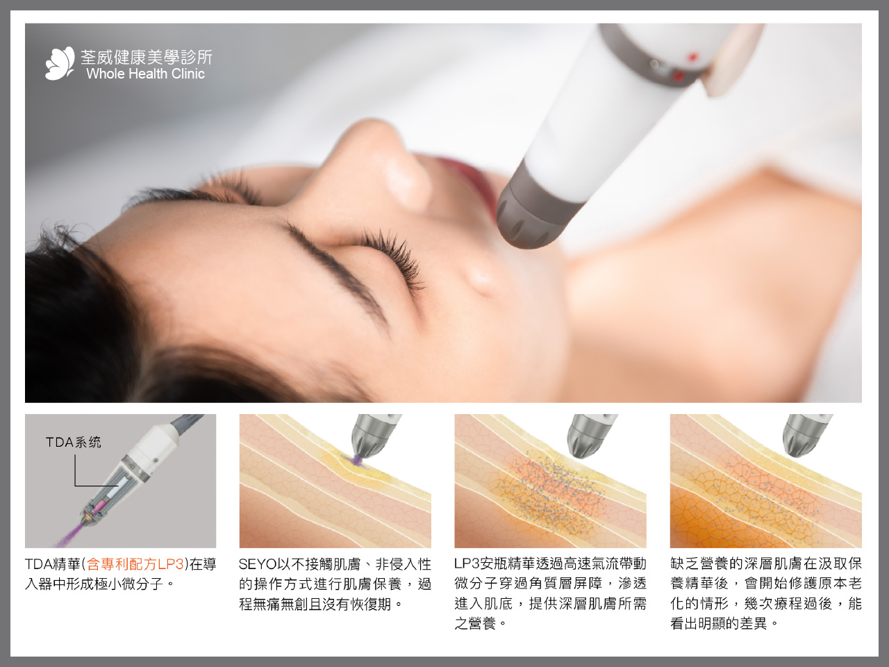 SEYO 水悠旗艦機採用德國專利 TDA 霧化高壓傳導技術與 LP3 微乳膠技術，溫和非侵入地將高濃度精華與純氧均勻導入肌底，養護極致水嫩透亮肌。適用於全臉補水、撫平細紋與頭皮保養。｜台北南港醫美推薦 荃威診所