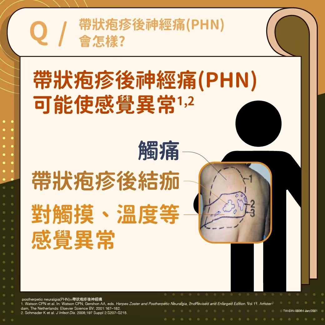 帶狀疱疹