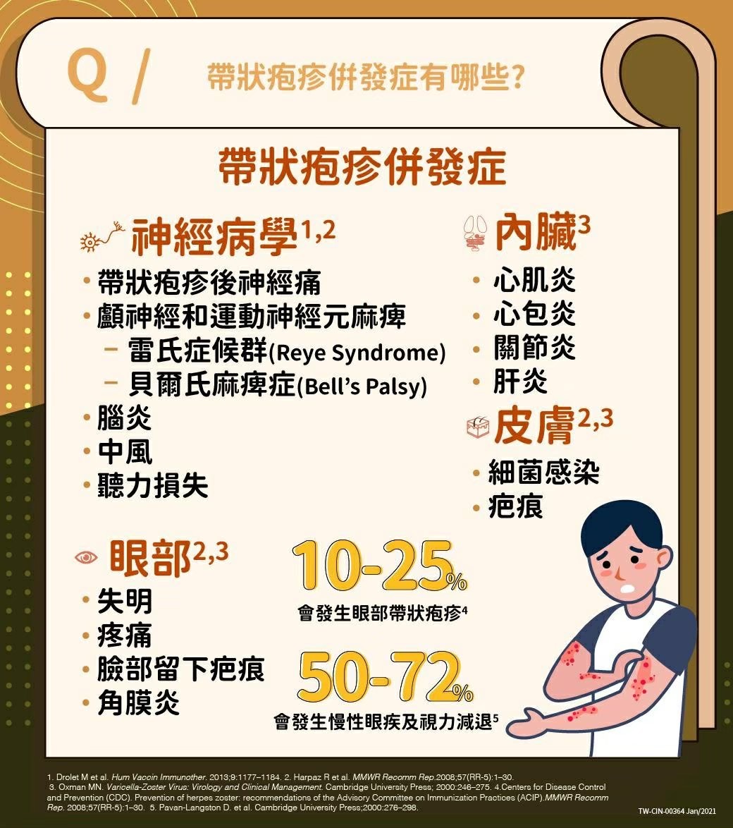 帶狀疱疹