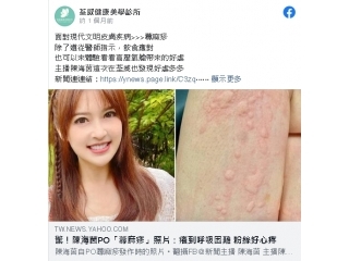 面對現代文明皮膚疾病>>>蕁麻疹