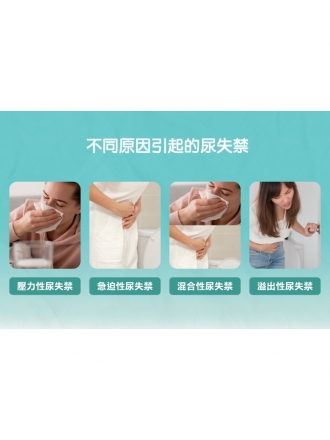 婦克漏雷射（G緊雷射）｜重拾青春活力，改善女性私密健康