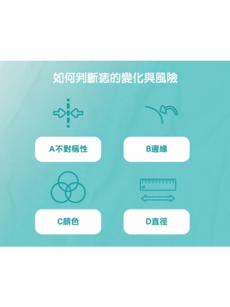 FOTONA 除痣