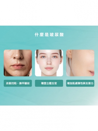 Juvéderm喬雅登玻尿酸｜自然輪廓，專屬妳的自信線條