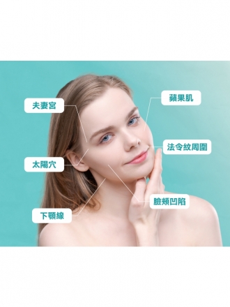 3D Sculptra 童顏針