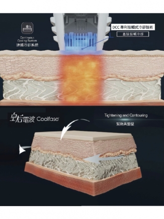 皇后電波 (Coolfase)：不止拉提，更是喚醒青春的鑰匙