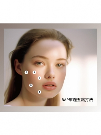 PROFHILO逆時針 BAP生物美學點注射技術臉部5點位置示意圖