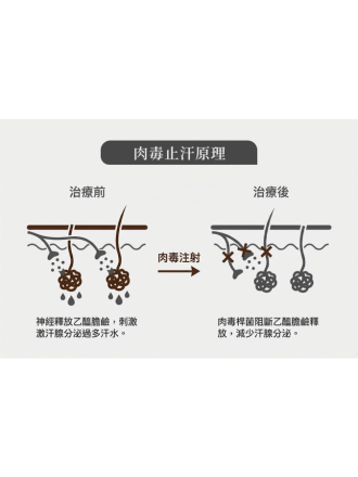 想打「保妥適肉毒」？荃威診所醫師詳解：告別皺紋、瘦小臉，一篇搞懂價格、效果與術後保養