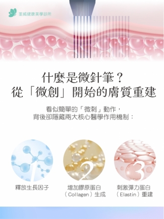 毛孔粗大、凹疤救星？揭開「微針筆 Microneedling」煥膚原理：比雷射更溫和的物理性修復選擇